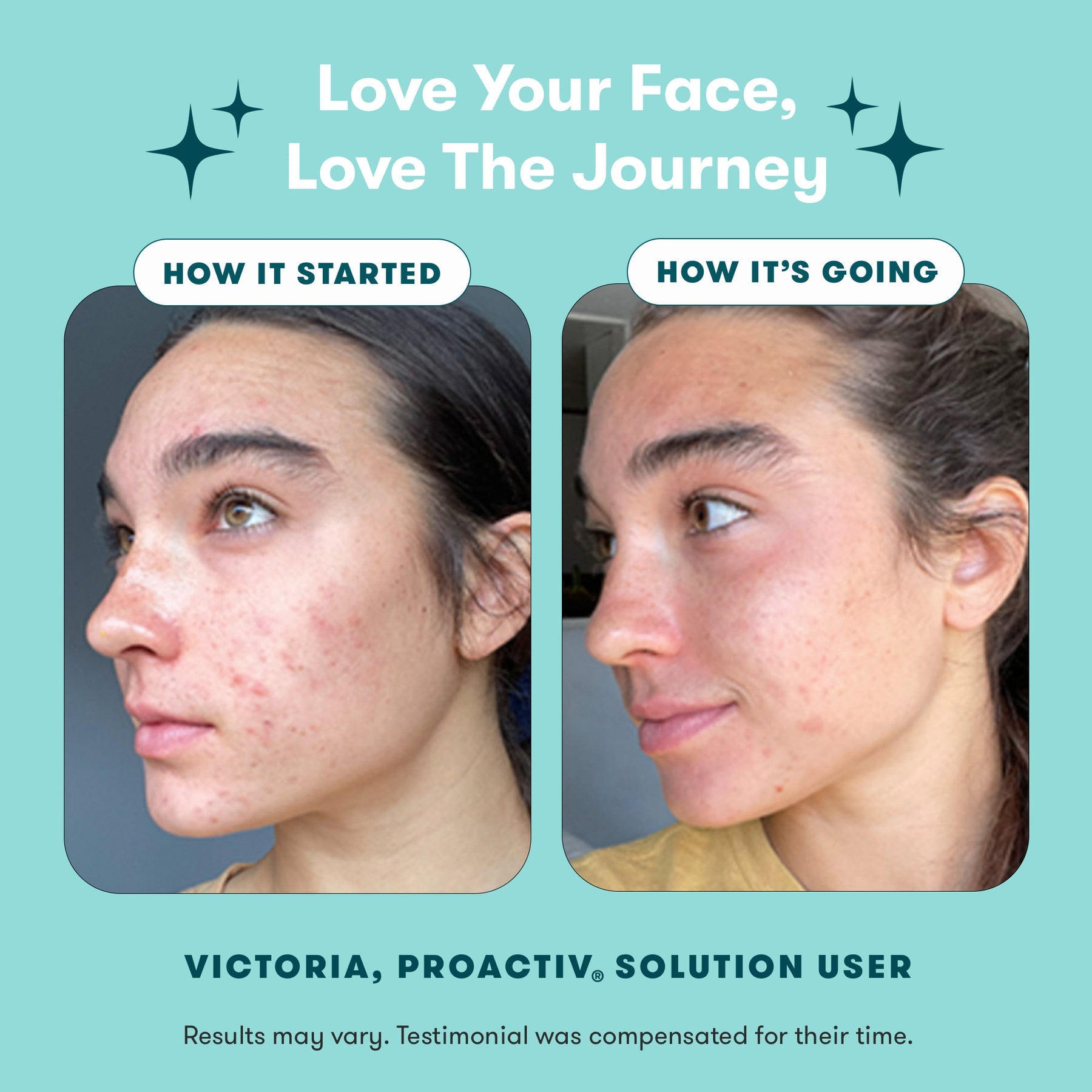 Proactiv Solution 3-StepRoutine 90 Day Supply